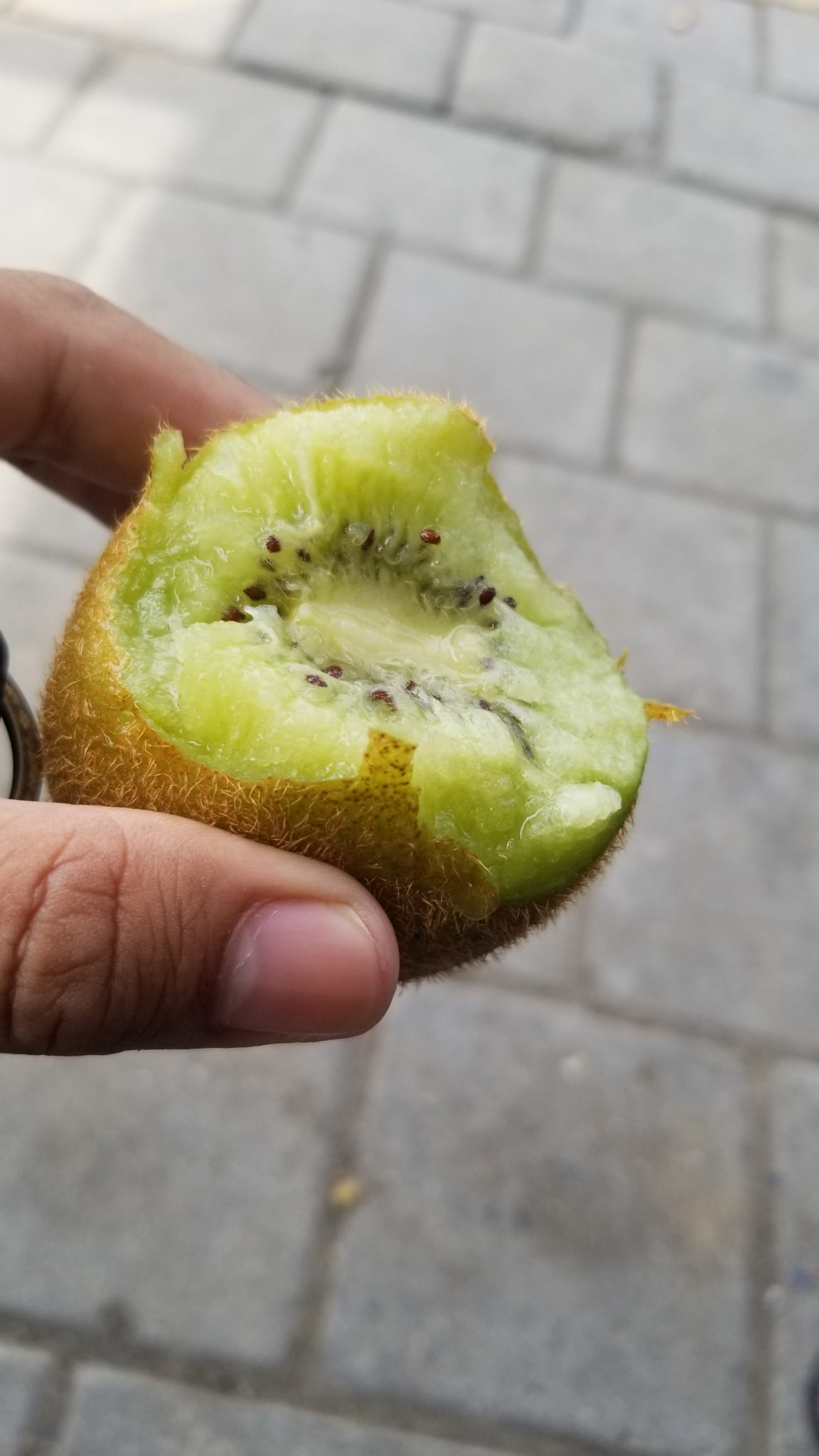 La peau du kiwi Diététicienne Nutritionniste Caudry
